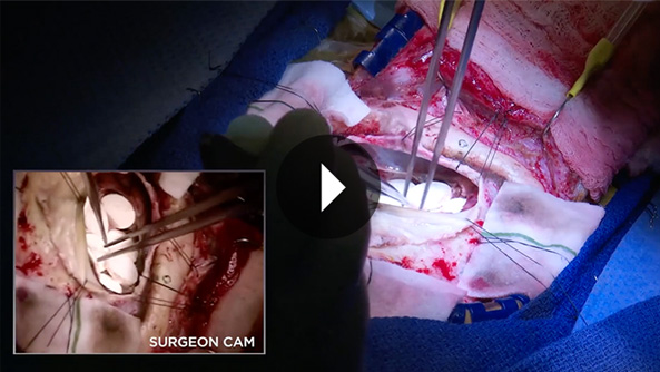 surgery-video